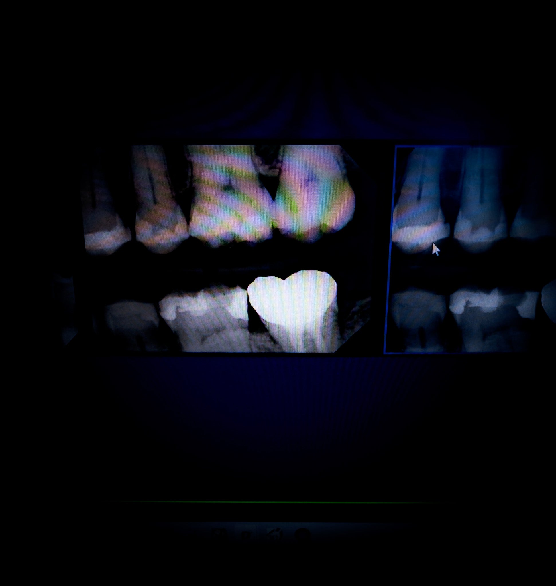 X-ray Heart